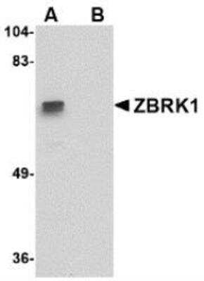 Western Blot ZNF350 Antibody Blocking Peptide
