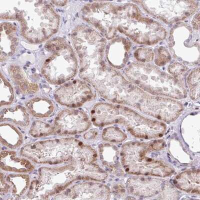 Immunohistochemistry-Paraffin ZNF354A Antibody