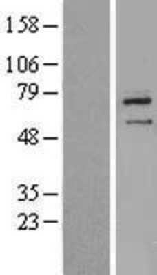 Western Blot: ZNF354B Overexpression Lysate (Adult Normal) [NBL1-18131] Left-Empty vector transfected control cell lysate (HEK293 cell lysate); Right -Over-expression Lysate for ZNF354B.