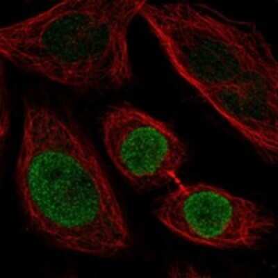 Immunocytochemistry/Immunofluorescence: ZNF354C Antibody [NBP3-17564] - Staining of human cell line SiHa shows localization to nucleoplasm.