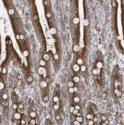 Immunohistochemistry-Paraffin: ZNF354C Antibody [NBP1-81352] - Staining of human duodenum shows strong cytoplasmic positivity in glandular cells.