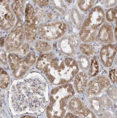Immunohistochemistry-Paraffin: ZNF354C Antibody [NBP1-81352] - Staining of human kidney shows moderate cytoplasmic positivity in cells in tubules.