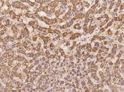 Immunohistochemistry-Paraffin: ZNF354C Antibody [NBP3-06035] - Immunochemical staining of human ZNF354C in human liver with rabbit polyclonal antibody at 1:500 dilution, formalin-fixed paraffin embedded sections.