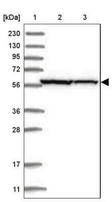 Western Blot: ZNF354C Antibody [NBP1-81352] - Lane 1: Marker  [kDa] 230, 130, 95, 72, 56, 36, 28, 17, 11.  Lane 2: Human cell line RT-4.  Lane 3: Human cell line U-251MG sp