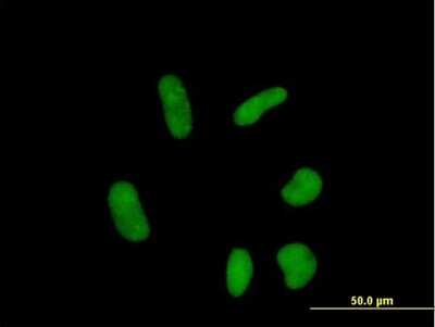 Immunocytochemistry/Immunofluorescence: ZNF358 Antibody [H00140467-B01P] - Analysis of purified antibody to ZNF358 on HeLa cell. (antibody concentration 10 ug/ml)
