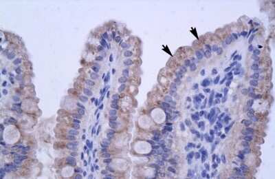 Immunohistochemistry ZNF358 Antibody - BSA Free