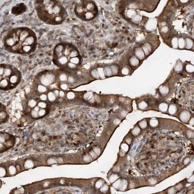 Immunohistochemistry-Paraffin ZNF358 Antibody - BSA Free