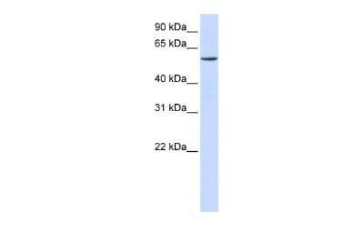 Western Blot: ZNF358 Antibody [NBP2-88595] - WB Suggested Anti-ZNF358 Antibody Titration: 0.2-1 ug/ml. ELISA Titer: 1:1562500. Positive Control: Human Lung