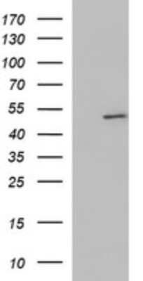 Western Blot: ZNF365 Antibody (9H5) [NBP2-46444] - Analysis of HEK293T cells were transfected with the pCMV6-ENTRY control (Left lane) or pCMV6-ENTRY ZNF365.