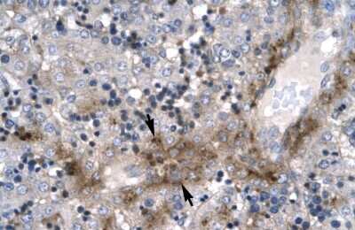 Immunohistochemistry-Paraffin: ZNF365 Antibody [NBP1-79999] - Human Liver Tissue, antibody concentration 4-8ug/ml. Cells with positive label: Hepatocytes (indicated with arrows) 400X magnification.