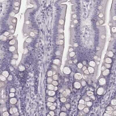 Immunohistochemistry-Paraffin: ZNF365 Antibody [NBP2-30451] - Staining of human duodenum shows low expression as expected.