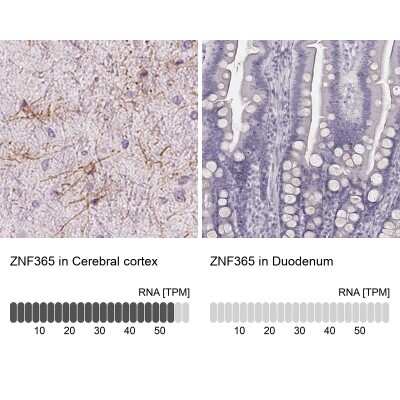 <b>Orthogonal Strategies Validation. </b>Immunohistochemistry-Paraffin: ZNF365 Antibody [NBP2-30451] - Staining in human cerebral cortex and duodenum tissues using anti-ZNF365 antibody. Corresponding ZNF365 RNA-seq data are presented for the same tissues.