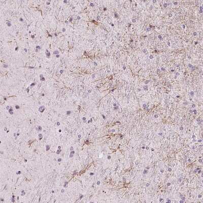 Immunohistochemistry-Paraffin: ZNF365 Antibody [NBP2-30451] - Staining of human cerebral cortex shows moderate cytoplasmic positivity in glial cells.