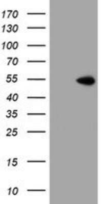 Western Blot: ZNF365 Antibody (OTI1B7) - Azide and BSA Free [NBP2-74945] - HEK293T cells were transfected with the pCMV6-ENTRY control (Left lane) or pCMV6-ENTRY ZNF365 (Right lane) cDNA for 48 hrs and lysed. Equivalent amounts of cell lysates (5 ug per lane) were separated by SDS-PAGE and immunoblotted with anti-ZNF365.