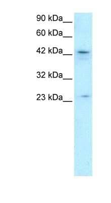 Western Blot: ZNF365 Antibody [NBP1-79999] - Titration: 0.2-1 ug/ml, Positive Control: HepG2 cell lysate.