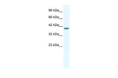 Western Blot: ZNF365 Antibody [NBP1-79999] - Reccomended Titration: 0.2 - 1 ug/ml Positive Control: HepG2