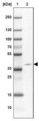 Western Blot: ZNF365 Antibody [NBP2-30451] - Lane 1: Marker [kDa] 250, 130, 100, 70, 55, 35, 25, 15, 10  Lane 2: Cerebral Cortex