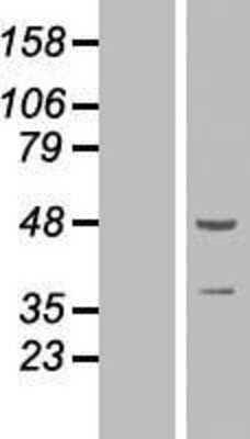 Western Blot ZNF365 Overexpression Lysate