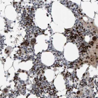 Immunohistochemistry-Paraffin: ZNF366 Antibody [NBP1-81922] - Staining of human bone marrow shows strong nuclear positivity in bone marrow poietic cells.