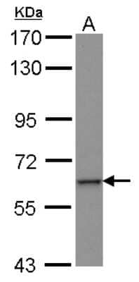 Western Blot: ZNF37A Antibody [NBP2-21001] - Sample (30 ug of whole cell lysate) A: HepG2 7. 5% SDS PAGE gel, diluted at 1:1000.