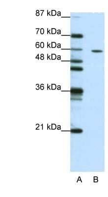 Western Blot: ZNF382 Antibody [NBP1-80380] - Titration: 1.25ug/ml, Positive Control: Jurkat cell lysate.