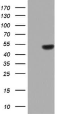 Western Blot: ZNF385B Antibody (OTI1H10) - Azide and BSA Free [NBP2-74948] - Analysis of HEK293T cells were transfected with the pCMV6-ENTRY control (Left lane) or pCMV6-ENTRY ZNF385B.