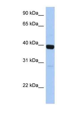 Western Blot: ZNF385B Antibody [NBP1-79420] - Human Liver cell lysate, concentration 0.2-1 ug/ml.