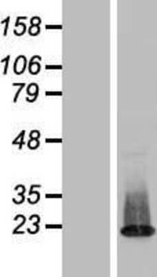 Western Blot: ZNF385C Overexpression Lysate (Adult Normal) [NBL1-18137] Left-Empty vector transfected control cell lysate (HEK293 cell lysate); Right -Over-expression Lysate for ZNF385C.