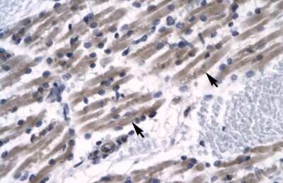 Immunohistochemistry ZNF391 Antibody - BSA Free