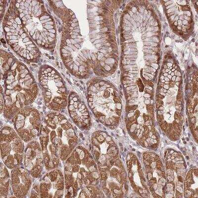 Immunohistochemistry-Paraffin: ZNF391 Antibody [NBP2-14715] - Staining of human stomach shows strong cytoplasmic and nuclear positivity in glandular cells.