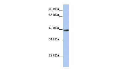 Western Blot: ZNF391 Antibody [NBP2-86486] - WB Suggested Anti-ZNF391 Antibody Titration: 0.2-1 ug/ml. Positive Control: 721_B cell lysateZNF391 is supported by BioGPS gene expression data to be expressed in 721_B