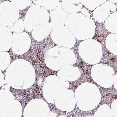 Immunohistochemistry: ZNF394 Antibody [NBP2-30743] - Staining of human bone marrow shows strong nuclear positivity in hematopoietic cells.