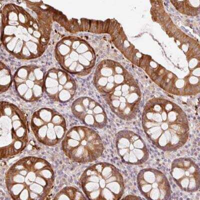Immunohistochemistry ZNF394 Antibody - BSA Free