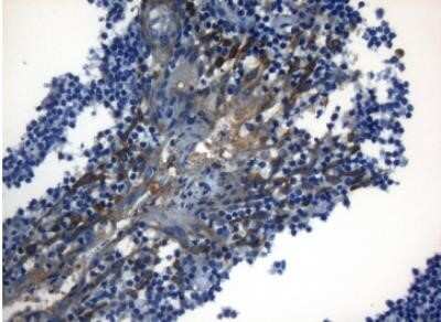 Immunohistochemistry ZNF394 Antibody (OTI1G9) - Azide and BSA Free