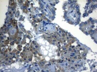 Immunohistochemistry ZNF394 Antibody (OTI1G9) - Azide and BSA Free