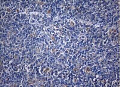 Immunohistochemistry ZNF394 Antibody (OTI1G9) - Azide and BSA Free