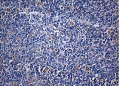 Immunohistochemistry-Paraffin ZNF394 Antibody (OTI1G9)