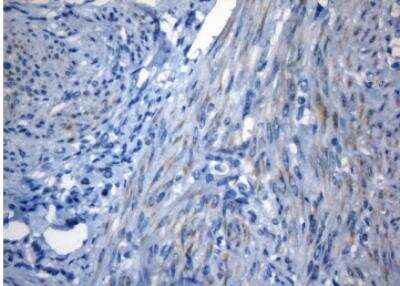 Immunohistochemistry-Paraffin ZNF394 Antibody (OTI1G9)