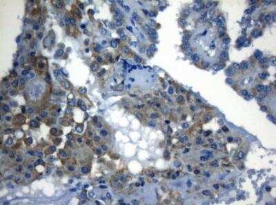 Immunohistochemistry-Paraffin ZNF394 Antibody (OTI1G9)
