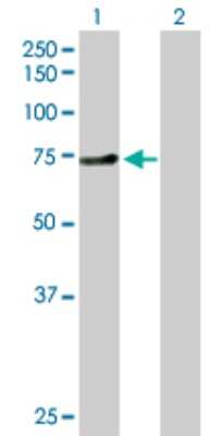 Western Blot: ZNF394 Antibody [H00084124-D01P] - Analysis of ZNF394 expression in transfected 293T cell line by ZNF394 polyclonal antibody.Lane 1: ZNF394 transfected lysate(64.30 KDa).Lane 2: Non-transfected lysate.