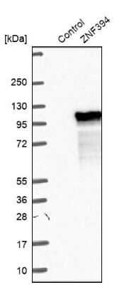 Western Blot: ZNF394 Antibody [NBP2-30743] - Analysis in control (vector only transfected HEK293T lysate) and ZNF394 over-expression lysate (Co-expressed with a C-terminal myc-DDK tag (3.1 kDa) in mammalian HEK293T cells).