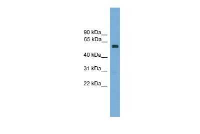 Western Blot: ZNF394 Antibody [NBP3-10431] - Western blot analysis using NBP3-10431 on Mouse Kidney  as a positive control. Antibody Titration: 0.2-1 ug/ml