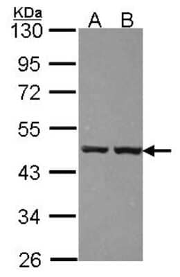 Western Blot: ZNF396 Antibody [NBP2-21004] - Sample (30 ug of whole cell lysate) A: 293T B: A431 10% SDS PAGE gel, diluted at 1:1000.
