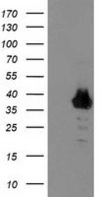 Western Blot: ZNF397 Antibody (1F3) [NBP2-01324] - HEK293T cells were transfected with the pCMV6-ENTRY control (Left lane) or pCMV6-ENTRY ZNF397 (Right lane) cDNA for 48 hrs and lysed. Equivalent amounts of cell lysates (5 ug per lane) were separated by SDS-PAGE and immunoblotted with anti-ZNF397.