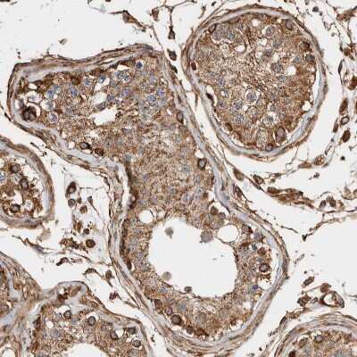 Immunohistochemistry-Paraffin: ZNF397 Antibody [NBP1-82753] - Staining of human testis shows strong granular cytoplasmic positivity in cells in seminiferous ducts.