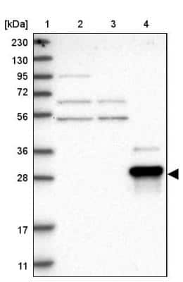 Western Blot: ZNF397 Antibody [NBP1-82753] - Lane 1: Marker  [kDa] 230, 130, 95, 72, 56, 36, 28, 17, 11.  Lane 2: Human cell line RT-4.  Lane 3: Human cell line U-251MG sp.  Lane 4: Human plasma (IgG/HSA depleted)