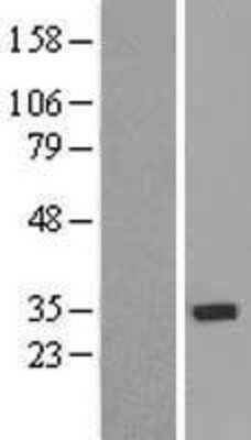 Western Blot: ZNF397 Overexpression Lysate (Adult Normal) [NBL1-18141] Left-Empty vector transfected control cell lysate (HEK293 cell lysate); Right -Over-expression Lysate for ZNF397.