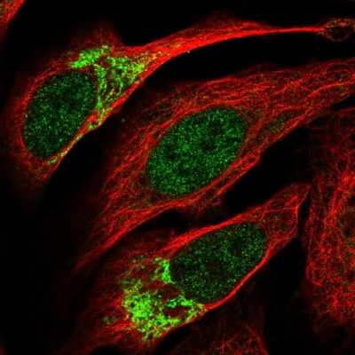 Immunocytochemistry/ Immunofluorescence ZNF398 Antibody - BSA Free