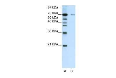 Western Blot: ZNF398 Antibody [NBP2-88682] - WB Suggested Anti-ZNF398 Antibody Titration: 0.2-1 ug/ml. ELISA Titer: 1:312500. Positive Control: HepG2 cell lysate