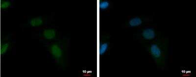 Immunocytochemistry/ Immunofluorescence ZNF406 Antibody